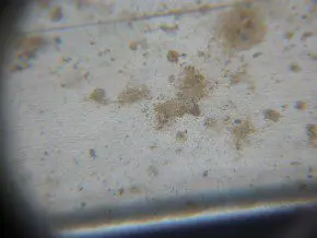 Oppervlakkige aantasting door tea staining.